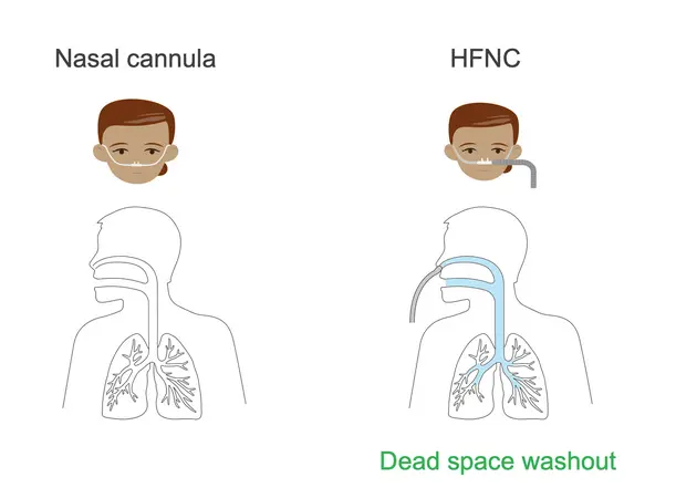 Oxygen Concentrator HFNC5