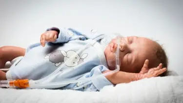 Oxygen Concentrator HFNC2