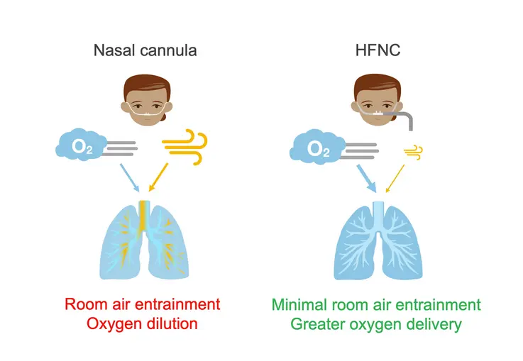 Oxygen Concentrator HFNC3