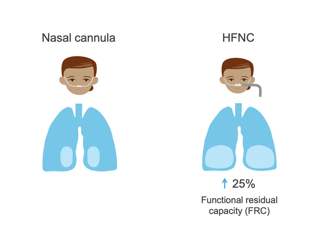 Oxygen Concentrator HFNC4