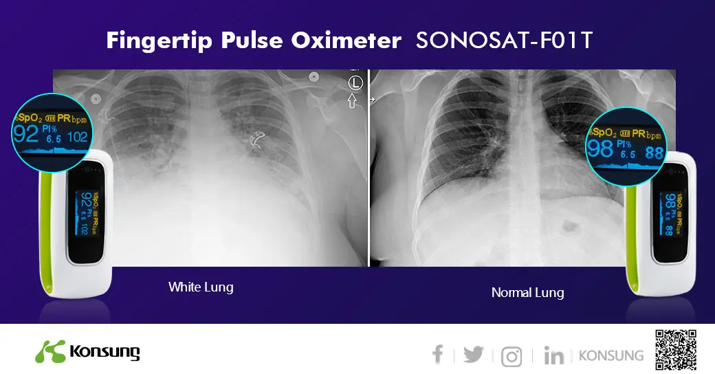 Konsung fingertip pulse oximeter